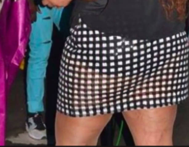 L'hymenoplastie : une pratique qui consiste à reconstruire l'hymen L'hymenoplastie : une pratique qui consiste à reconstruire l'hymen