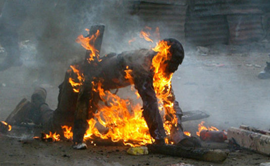 Cheikh Diop, l’homme brûlé par son fils, est décédé