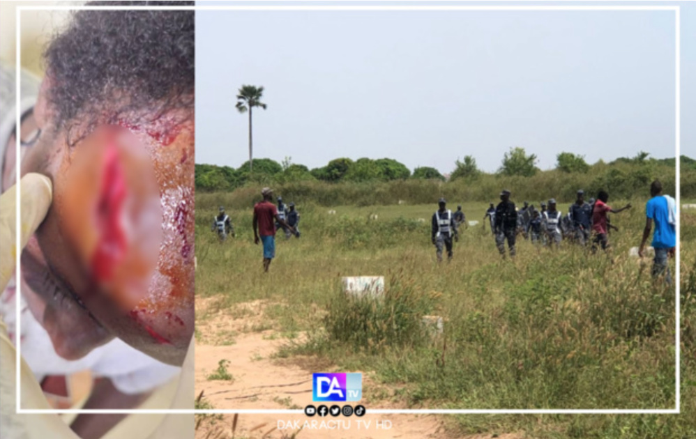 Litige foncier à Mbeye/violents affrontements en FDS et populations: des arrestations et des blessés graves, la mairie de Bambilor saccagée Litige foncier à Mbeye/violents affrontements en FDS et populations: des arrestations et des blessés graves, la mairie de Bambilor saccagée