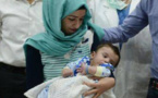 Un bébé né avec huit bras et jambes opérés avec succès