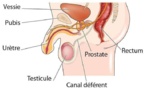 Tout savoir sur la prostate