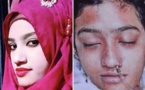 Nusrat Jahan Rafi, victime d'agression sexuelle brûlée vive, bouleverse le Bangladesh