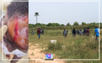 Litige foncier à Mbeye/violents affrontements en FDS et populations: des arrestations et des blessés graves, la mairie de Bambilor saccagée